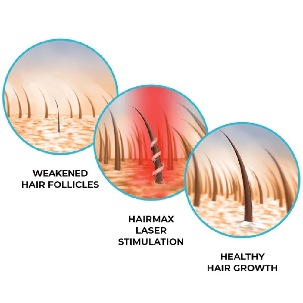 HairMax Ultima 9 Hair Growth LaserComb Lāzerķemme
